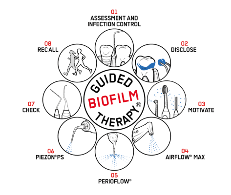 guided-biofilm-therapy-english